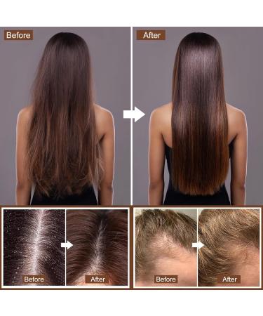 Ginger Hair Growth Shampoo Bar & Conditioner Set | Natural Anti Hair Loss PH Balanced Silicone-Free | Boost Hair Regrowth - Buy Online on GoSupps.com