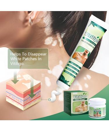 Bploar Vitiligo Cream white spot cream improves skin pigmentation skin therapy cream treats skin problems effectively moisturizes and cares suitable for all skin types - Buy Online on GoSupps.com