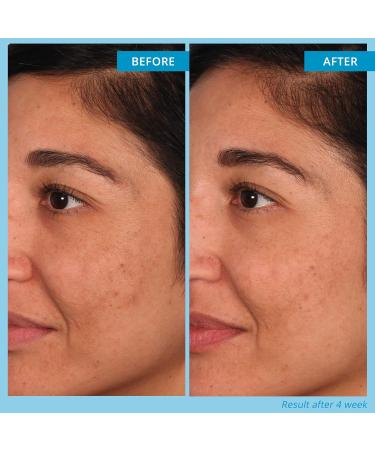 SKINN Multi-Acid Resurfacing Pads - Glycolic Lactic & Salicylic Acid Exfoliating Peel for Face Neck & Decollete | 60 Pads for Brightening & Toning Skin - Buy Online on GoSupps.com