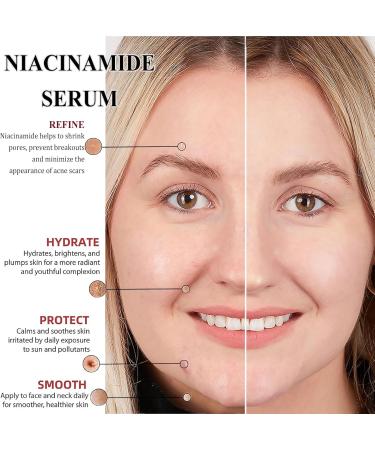 5% Niacinamide Face Serum Dark Spot Correcting Glow Serum Day & Night Serum for Dry &Sensitive Skin Balanced Grease Pore Contraction -Fade Acne Marks Facial Serum Anti Aging Face Cream Skin Repair - Buy Online on GoSupps.com