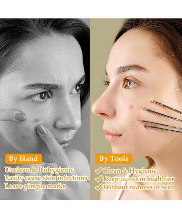 CiciIng Blackhead Remover Tool 9-in-1 Stainless Steel Pimple Extractor Set with Non-slip Handle Includes Pimple Patch for All Skin Types Silver - Buy Online on GoSupps.com