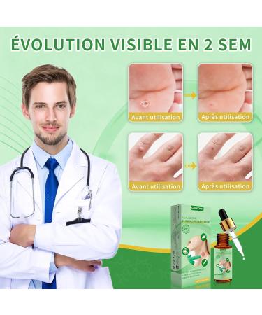 Action Rapide Anti Verrue pour Verrue Plantaire Verrue Commune Verrue Plate Soin Verrues Pieds & Mains limination Doux des Verrues Plantaires Action Rapide 15 ml 15 ml (Lot de 1) - Buy Online on GoSupps.com