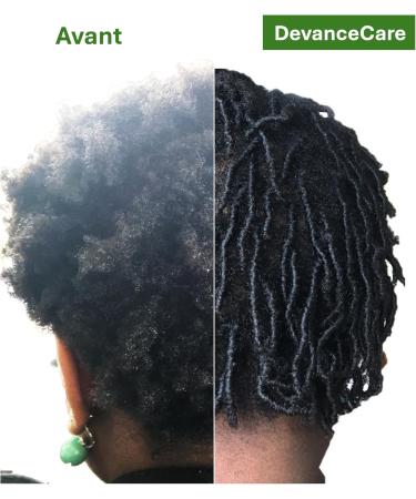 Nourishing hair care for frizzy curly curly hair - powder vegan and natural - single dose 3G - Buy Online on GoSupps.com