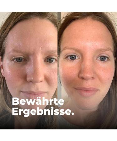  Vaud VAUD Anti-aging Capsules for Skin Hair and Nails - Anti-Wrinkle - 90 Capsules - Highly concentrated with Fucus Vesiculosus Viola Tricolore and Zinc - Natural - Laboratory tested - Made in - Buy Online on GoSupps.com