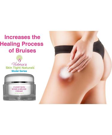 Clear Skin Scar & Bruise Cream - Model Series - Buy Online on GoSupps.com