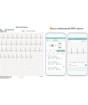 EMAY Portable ECG Monitor (for iPhone & Android  Mac & Windows) | Wireless EKG Monitoring Devices with Heart Rate & Rhythm Tracking - Buy Online on GoSupps.com
