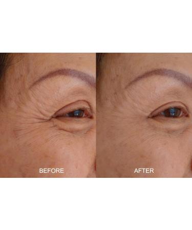 Buy Magic Serum - No Needle Anti-Aging Solution with BioActive Argireline & Peptides - Smooth Expression Lines & Creases - 1 oz - Buy Online on GoSupps.com