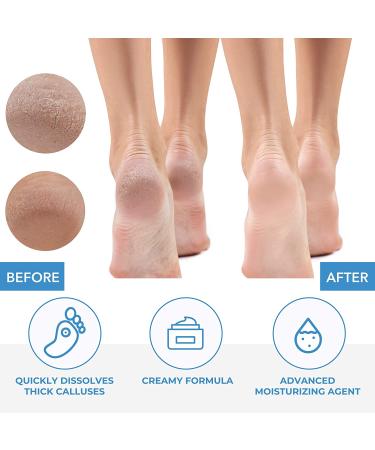 ForPro Premium Callus No More! Callus Remover 32 oz. | Fast-Acting Formula - Buy Online on GoSupps.com
