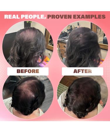 Fibers for Thinning Hair - Medium Brown | 100% Natural Hair Building Powder for Women | Conceals Hair Loss & Bald Spots | 2-Month Supply - Buy Online on GoSupps.com