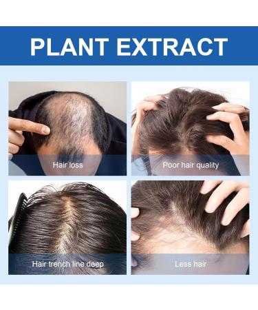  Waymaytecy 60ml Hair Growth Serum Hair Growth Oil for Women and Men Hair Treatment Scalp and Hair Strengthening Reduces Hair Loss - Buy Online on GoSupps.com