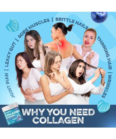 Marine Collagen Gummies Hydrolysed Collagen Peptides w/Biotin Hyaluronic Acid & Vitamin C Collagen Supplements for Women & Men Collagen for Skin Hair & Nails (One Size Blueberry) Blueberry 1 count (Pack of 120) - Buy Online on GoSupps.com