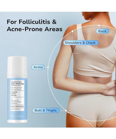 BellamiLuxx Folliculitis Acne Lotion for Body: Helps Reduce Itch Redness Body Acne Bumps & Uneven Texture with Salicylic & Glycolic Acid + Botanicals - Gentle Care for Folliculitis-Prone Skin - Buy Online on GoSupps.com