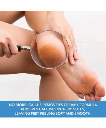 ForPro Premium Callus No More! Callus Remover 32 oz. | Fast-Acting Formula - Buy Online on GoSupps.com