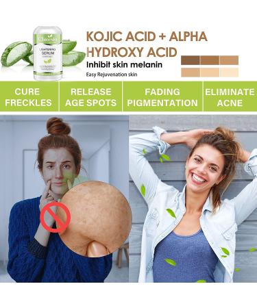 Skin Brightening Serum with Kojic Acid - Dark Spot Corrector for Face & Body - Fade Hyperpigmentation & Melasma - 1 oz (Pack of 2) - Buy Online on GoSupps.com