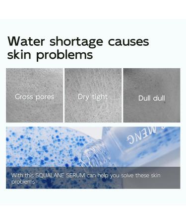 2 PCS JING MENG SQUALANE B5 SERUM ARGIRELINE SERUM MATRIXYL 3000 SERUM Collagen Booster Repair Dry Skin FIRMER SKIN DEEP MOISTURIZING GLOW SKIN - Buy Online on GoSupps.com