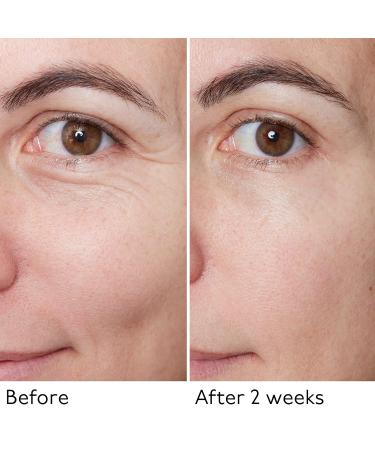 By Terry Hyaluronic Global Face Serum - Reduces Wrinkles & Fine Lines Vegan Fragrance-Free All Skin Types - 1.1 fl oz | International Shipping Available - Buy Online on GoSupps.com