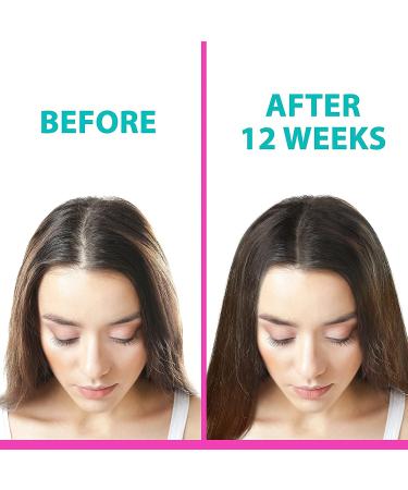 Z2 Hair Growth Serum - 1.69 fl oz | Natural Scalp Treatment for Hair Regrowth | Powerful Solution for Women and Men | Intensive Strengthening with Essential Oils - Buy Online on GoSupps.com