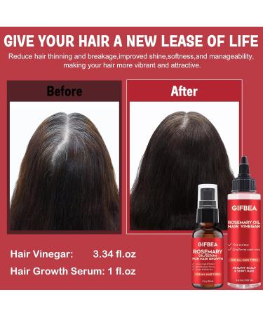 Rosemary Hair Growth Serum with Hair Vinegar Rinse - Scalp Treatment for Balance, Moisture, and Growth - Buy Online on GoSupps.com