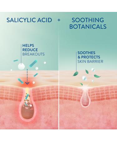 Cetaphil Gentle Clear Acne Moisturizer With Salicylic Acid | Hydrating Face Moisturizer Treats Sensitive Acne Prone Skin | Fragrance-Free | Non-Comedogenic | Dermatologist Recommended - Buy Online on GoSupps.com