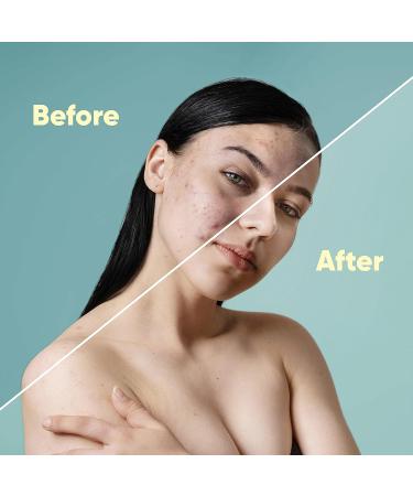 ALIVELAB Centella Dressing Powder 0.27oz - Acne & Oily Skin Treatment - Exposed Skin Care Product - Buy Online on GoSupps.com