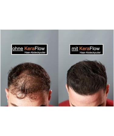 KeraFlow Root Powder - Hair Concealer & Thickening Solution for Grey Roots & Thinning Hair (4g Black) | Shop Internationally - Buy Online on GoSupps.com