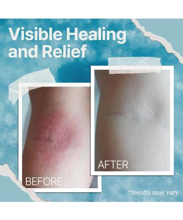 Natural Soothing Cream for Eczema & Psoriasis | Sea Moss & Colloidal Oats | Hydrating Sensitive Skin Cream (4 Oz - Buy Online on GoSupps.com