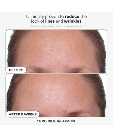 Paula's Choice Favorites Mini Kit 4 Piece Set Includes 2% BHA Exfoliant 1% Retinol Treatment 10% Azelaic Acid Booster Youth Extending SPF 50 Moisturizer Travel Skin Care Set for Glowing Skin - Buy Online on GoSupps.com