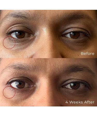 Peptide Eye Gel | Hydrating Firming & Brightening | Reduce Fine Lines | Fragrance Free (0.4 Oz - Buy Online on GoSupps.com