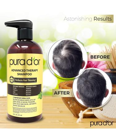 PURA D'OR Advanced Therapy Shampoo 16oz | Reduces Hair Thinning, Increases Volume | Biotin, Argan Oil, Aloe Vera | For All Hair Types Men & Women - Buy Online on GoSupps.com