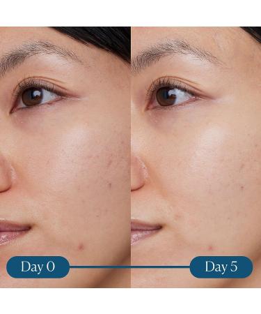 ELEMIS Dynamic Resurfacing Super-C Serum 30mL - Anti-Aging Antioxidant with Vitamin C - Buy Online on GoSupps.com