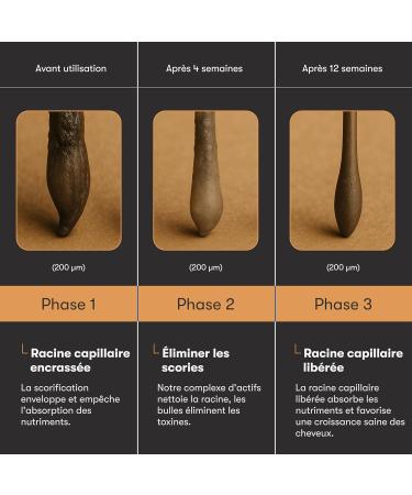 Overnight Hair Growth S rum - S rum capillaire en cas de chute de cheveux - Avec romarin panth nol et aloe vera - Favorise la croissance des cheveux - Alternative naturelle au minoxidil - Buy Online on GoSupps.com