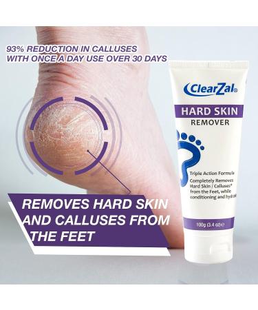 Clearzal Foot Cream for Hard Skin - Callus and Corn Removal, Hydrating Triple Action Formula with Aloe Vera - 3.4oz - Buy Online on GoSupps.com