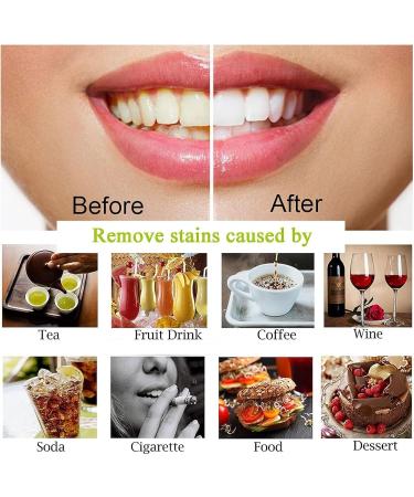 Amore Paris Teeth Whitening Powder Hsadav Amore Paris Teeth Whitening Powder Activated Coconut Charcoal Teeth Whitening Effectively Removes Coffee and Tobacco Stains - Buy Online on GoSupps.com