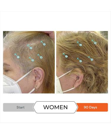 Hair Thinning & Hair Growth Kit w/Revita Hair Stimulating Shampoo and Revita Hair Growth Supplement Tablets for Men & Women (All Types of Hair Loss) - Buy Online on GoSupps.com