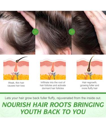 Rosemary Oil for Hair Growth & Skin Care -60ml 100% Pure Rosemary Essential Oil for Eyebrow and Eyelash Nourishes The Scalp Stimulates Hair Growth for Men Women - Buy Online on GoSupps.com