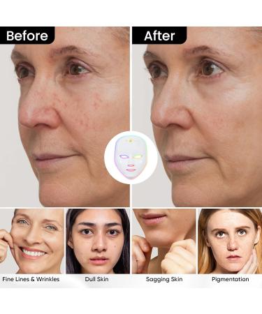 LED Mask Light Therapy - 7 Color Wireless Device for Anti-Aging Wrinkles Breakouts & Pigmentation - Home Skincare Blue Red Light Therapy - Buy Online on GoSupps.com