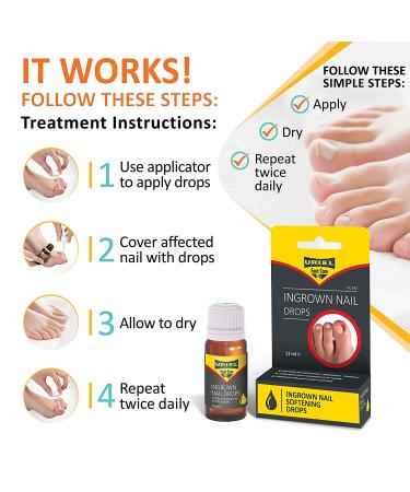 URIEL Advanced Treatment Ingrown Toenail Drops - Effective Solution for Pain Relief and Healing - Buy Online on GoSupps.com