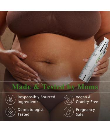 Abera Ovela Maternity Stretch Mark Cream with Eye Mask for Pregnancy and Weight Fluctuations Stretch Mark Treatment Pregnancy Must Haves Deep Stretch Mark Removal All Skin Types 1.69 fl oz - Buy Online on GoSupps.com