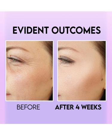 Eye Bag Remover & Dark Circle Cream with Retinol & Caffeine | Anti-Aging Eye Brightener for Wrinkles & Fine Lines - Buy Online on GoSupps.com