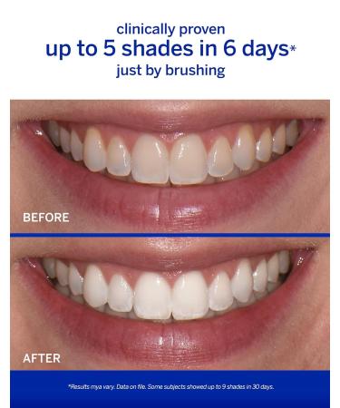 Buy Supersmile The Works Whitening Toothpaste & Activator - Sassy Mint | International Shipping Available - Buy Online on GoSupps.com
