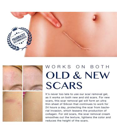 Scar Remover Gel for C-Section Stretch Marks Acne Surgery - 30g (1.05oz) | Effective on Old & New Scars - Buy Online on GoSupps.com