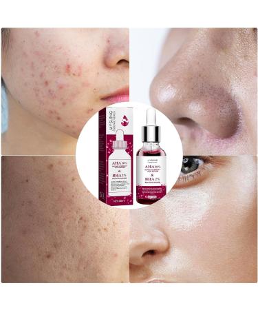  Pekoluta Anti-Redness Serums - Rosacea with Natural Moisturizing Fruit Acids - Redness Corrector Water Oil Balance Facial Care 30ml improves skin relieves rosacea Pekoluta - Buy Online on GoSupps.com
