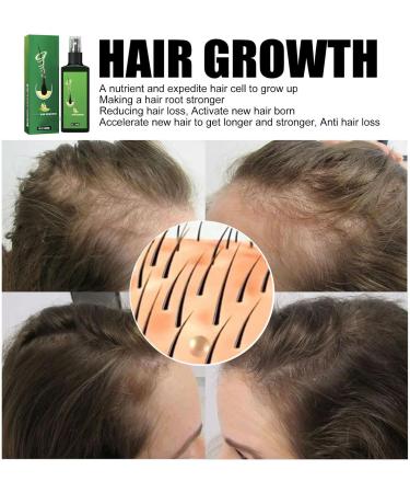  Beslibate 2 x Organic Growth Sprays More Nutritious Ginger Sprays for Women Men Hair Loss Treatment 100ml growhairthliquid-2 - Buy Online on GoSupps.com