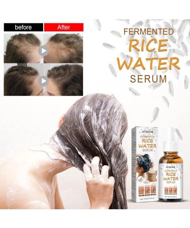 4 Piece Fermented Rice Water Serum - Natural Hair Growth & Anti-Hair Fall Solution | 10ml Regrowth Lotion for Thinner Hair - Buy Online on GoSupps.com