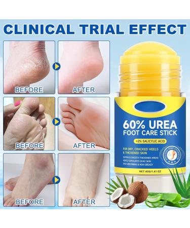 Stick cr me l'ur e 60% + 2% acide salicylique stick exfoliant et hydratant pour pieds mains genoux et coudes secs et crevass s liminateur de callosit s baume nourrissant rapide (4pcs) - Buy Online on GoSupps.com