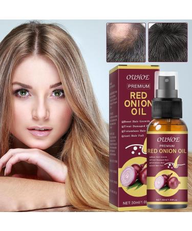 Onion Hair Thickening Spray - 30ml Onion Oil Hair Anti Loss Spray | Red Onion Hair Oil For Hair Regrowth Strengthening Hair Roots And Follicles | Pure Onion Oil Spray For Hair Thickening - Buy Online on GoSupps.com
