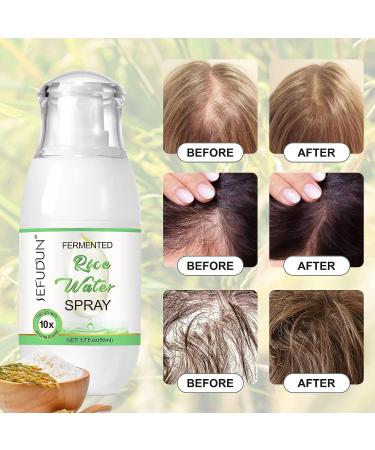 Rice Water Hair Growth Spray for Women 1.7Fl.oz - Hair Loss Treatment - Buy Online on GoSupps.com