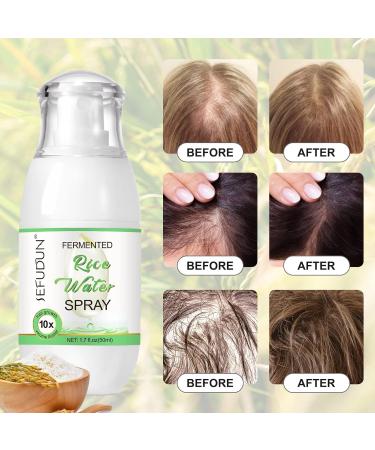 Hair Growth Serum | Rice Water Spray for Women | Natural Hair Moisturizer & Conditioner | Effective Hair Loss Treatment - 1.7 fl.oz - Buy Online on GoSupps.com