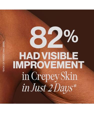Gold Bond Age Renew Crepe Corrector Body Lotion 396g Pump Crepey Skin Lotion With Omega Fatty Acids Antioxidants and Botanicals to Visibly Firm Tighten and Hydrate Dry Crepey Skin 396g 396 g (Pack of 1) - Buy Online on GoSupps.com