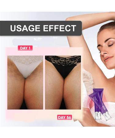 Crema Aclaradora para Axilas y Zonas ntimas - Elimina Manchas en Piel Efecto Suave 30ML - Buy Online on GoSupps.com